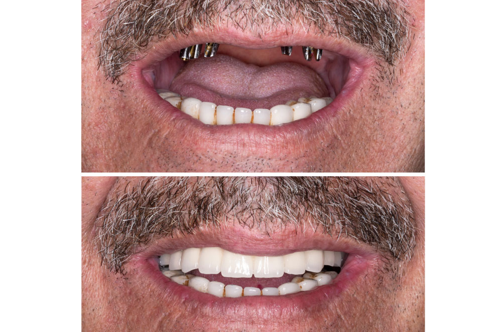 Issaquah Dentist Office