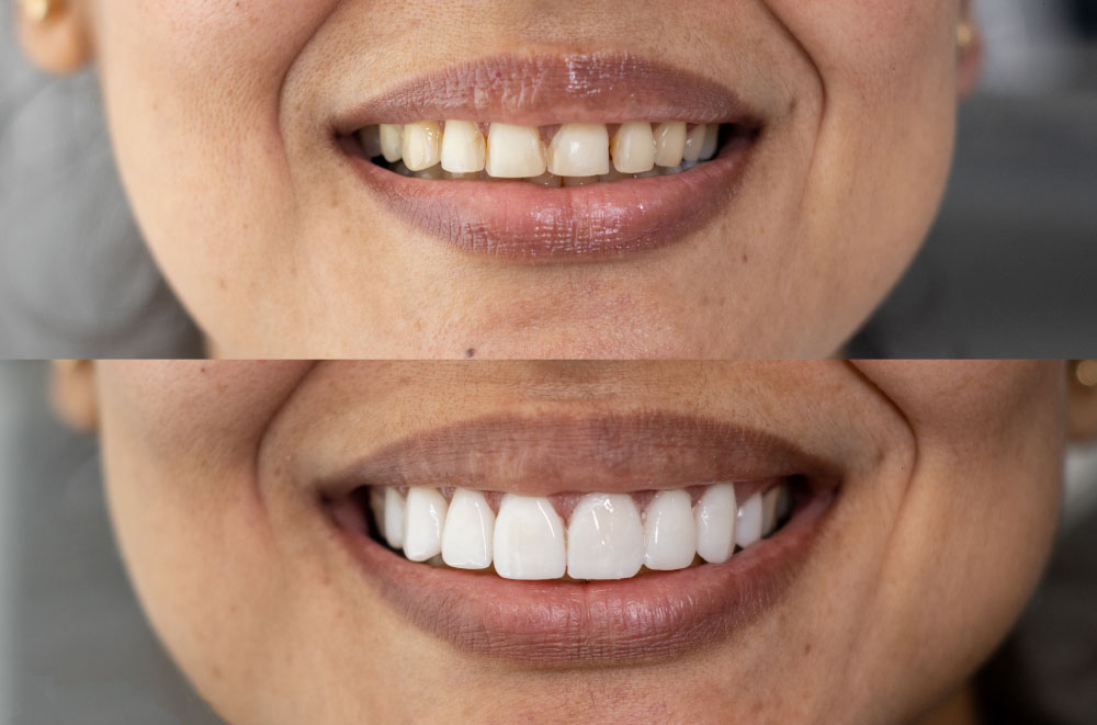 Issaquah Dentist Office
