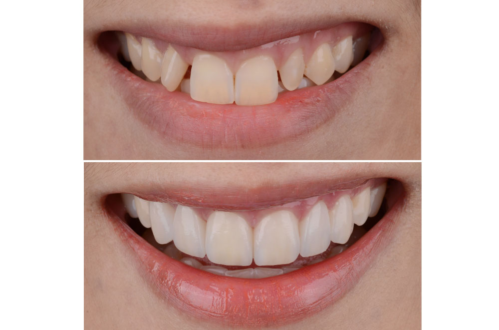 Issaquah Dentist Office