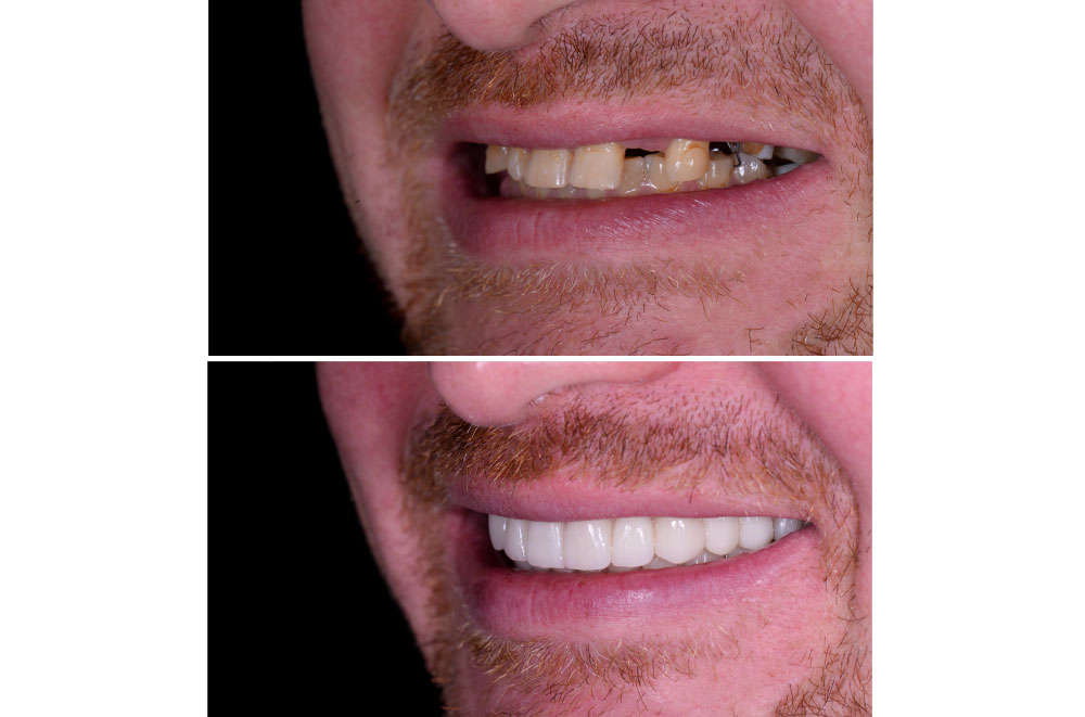 Issaquah Dentist Office