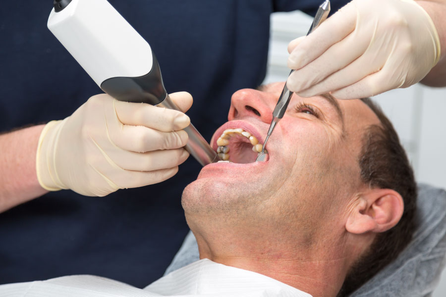 Issaquah CEREC Crowns