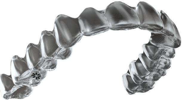 Issaquah Invisalign Dentist